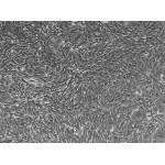 Human Exfoliated Deciduous Teeth Stem Cells (SHED)